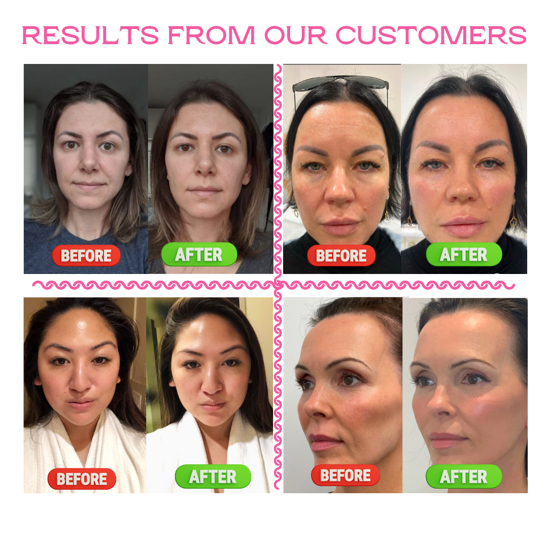 7 LED and EMS Facial Sculpting and Lifting Massager